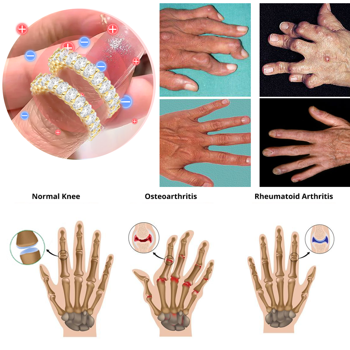 【 Official Brand Store 】Magnetology Moissanite Diamond Ring（🔥 Black Friday Presale is On! 🔥)