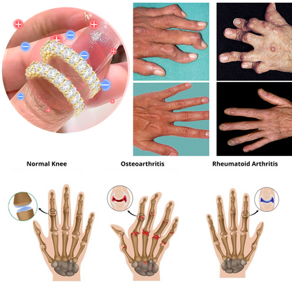 【 Official Brand Store 】Magnetology Moissanite Diamond Ring（🔥 Black Friday Presale is On! 🔥)