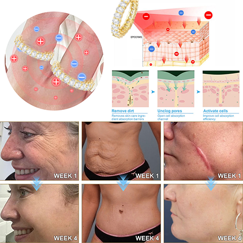 【 Official Brand Store 】Magnetology Moissanite Diamond Ring（🔥 Black Friday Presale is On! 🔥)